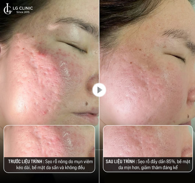 Khách hàng của LG Clinic