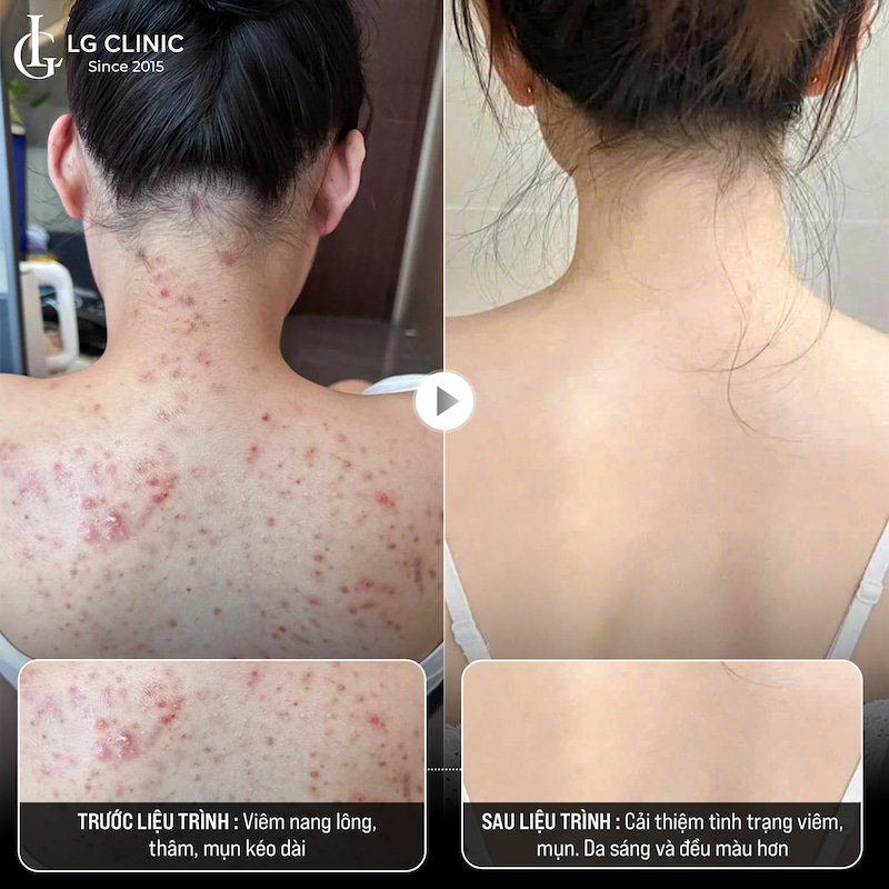 Khách hàng LG Clinic